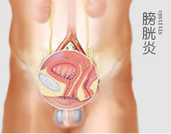 长治泌尿专科医院